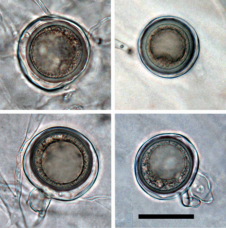 oogonia containing aplerotic oospores, with large ooplasts which were pale brown on maturity; antheridia exclusively paragynous, generally situated adjacent to the oogonial stalk; scale bar = 25micro;m 
